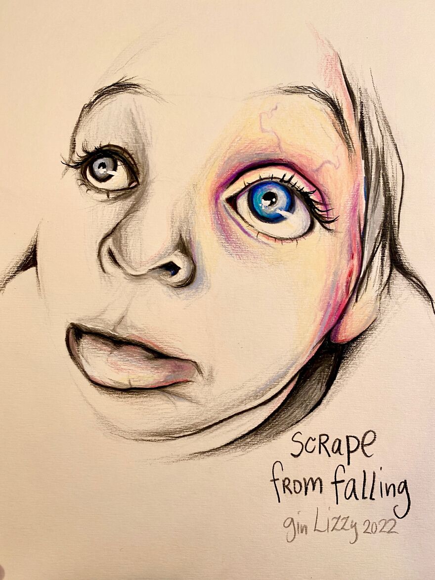 I Drew A Series Of Portraits Of My Friends' Self-Documented Injuries & Medical Issues I Drew A Series Of Portraits Of My Friends' Self-Documented Injuries & Medical Issues