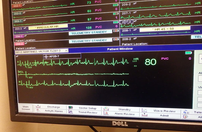 Only People With Rare Body Features Joined This Thread And Shared 35 Of Their Body Anomalies - 28