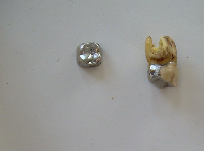 30 Brilliant Stories About The Coolest Things People Found While Using Metal Detectors