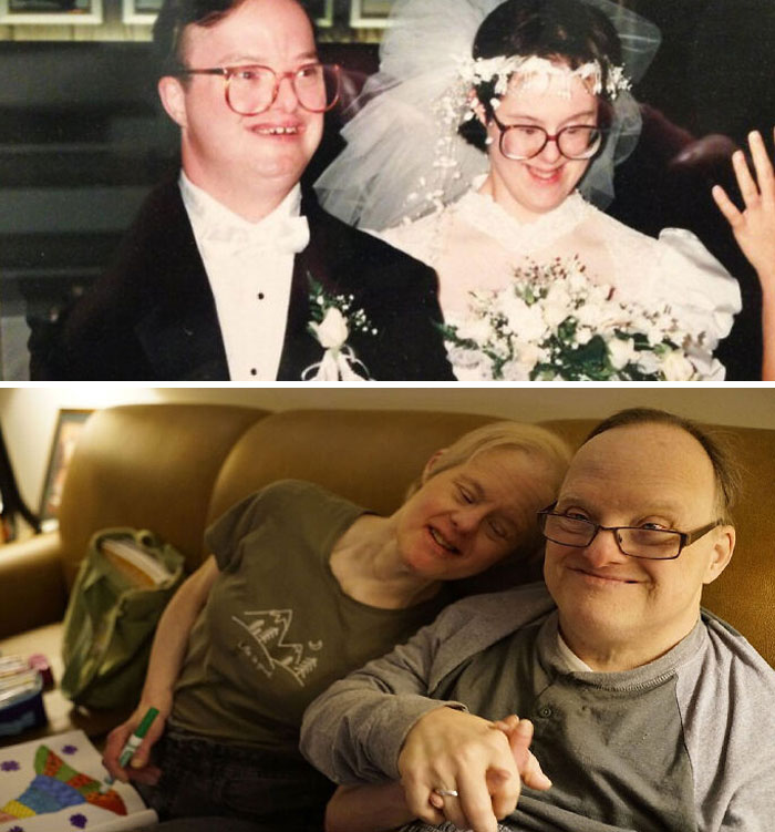 Couple With Down Syndrome Told Not To Marry, Prove Critics Wrong 25 Years Later