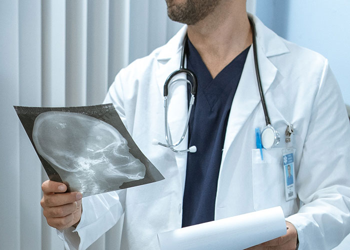 Doctor in white coat reviewing a disturbing x-ray image, representing doctors sharing disturbing experiences at work.