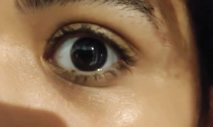 Only People With Rare Body Features Joined This Thread And Shared 35 Of Their Body Anomalies - 13