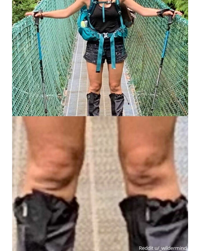 "My Knees Kind Of Resemble Baby Faces In Utero"