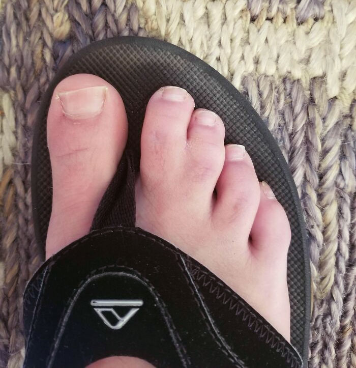 Yes, I'm An Incredible Swimmer