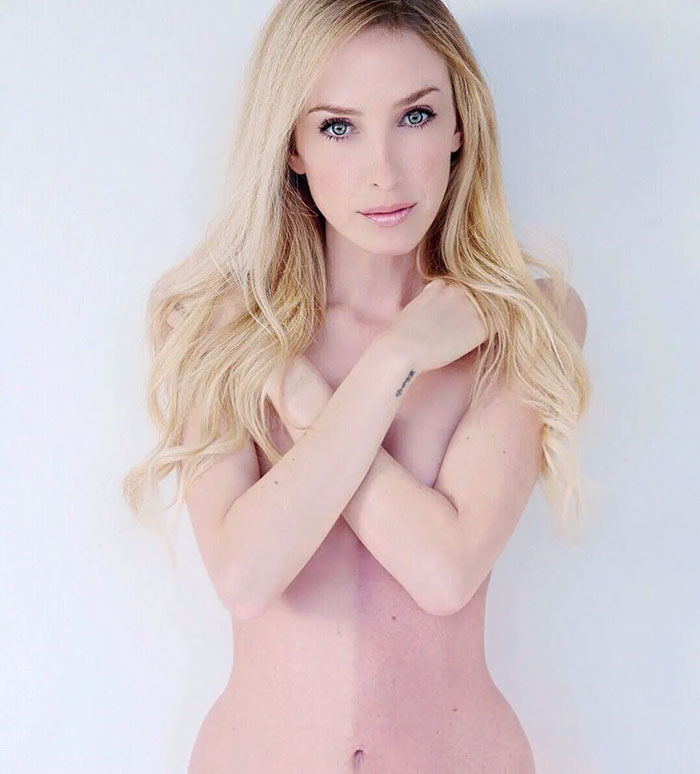 Chimeras Are Organisms With Two Different Sets Of DNA. Human Chimerism Is Rare, But Its Characteristics Are: Two Distinct Red Blood Cell Lineages Or Skin Pigmentation