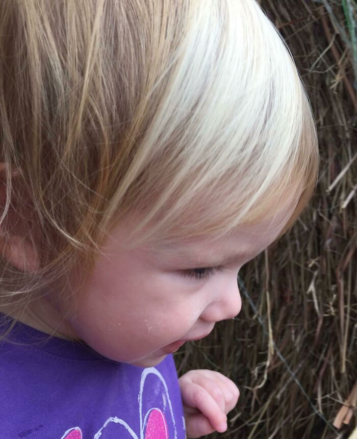 Her Birthmark Created Awesome Highlights