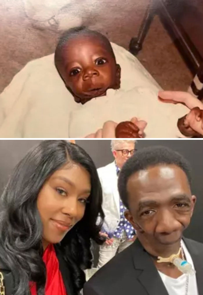 Born With A Rare Congenital Disorder Called Otofocial Syndrome Chicago Resident Joseph Williams Does Not Have A Jaw