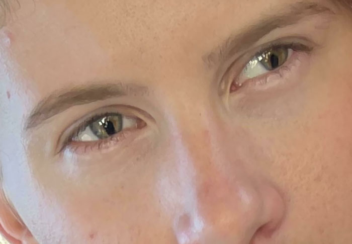 My Coworker Has 2 Melting Pupils