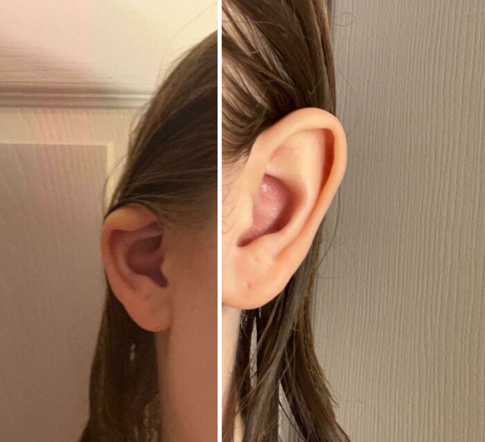 I Have Two Different Ears