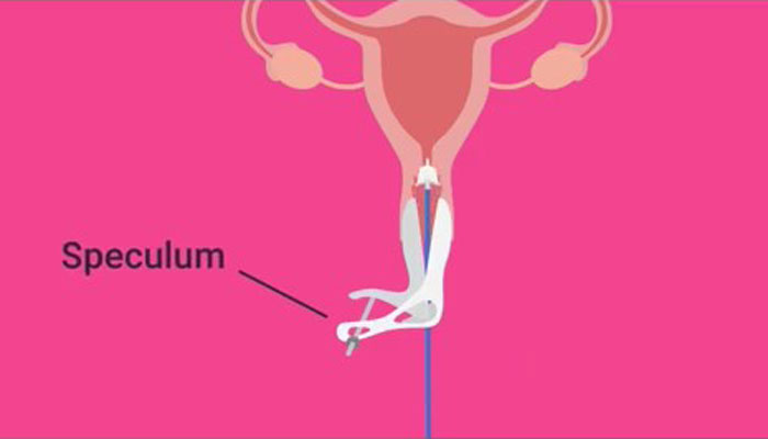 Woman Was Diagnosed With Cervical Cancer 3 Times And Shares The Hard And Joyous Days She Has On TikTok - 16