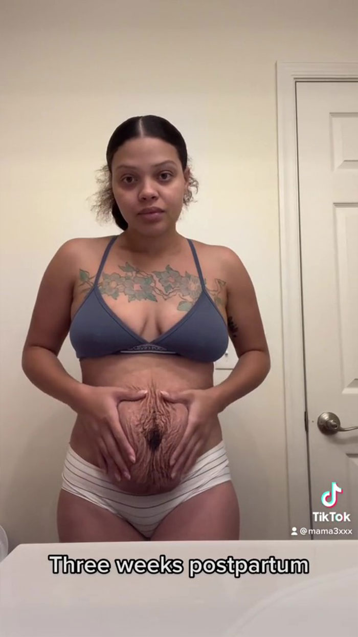 TikTok Mom Exposes Her Postpartum Journey To Combat Unrealistic Depictions Of Post-Pregnancy Bodies