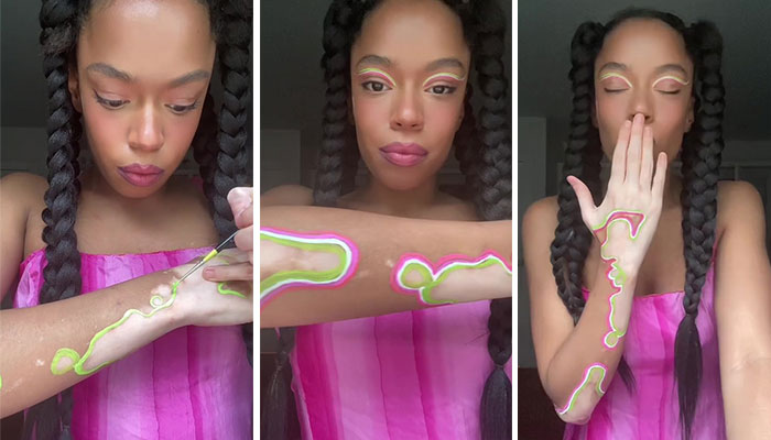 Woman Matches The Color Of The Paint She Outlines Her Vitiligo Spots With To Her Outfits, And People Can’t Get Enough Woman Matches The Color Of The Paint She Outlines Her Vitiligo Spots With To Her Outfits, And People Can’t Get Enough