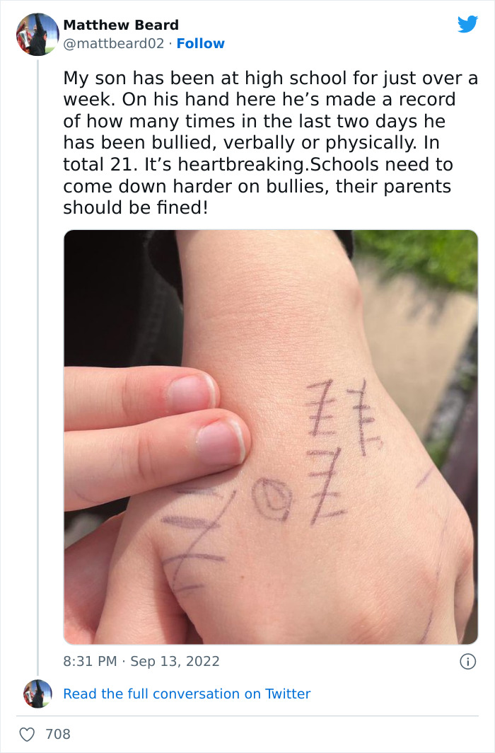 Father Is Upset As His Son Comes Home From School With Marks On His Hand Recording Times He Was Bullied Over 2 Days