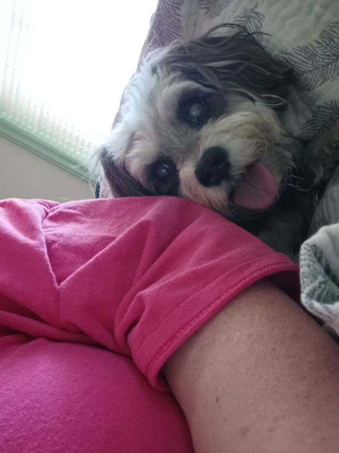 My Rescue Addie Has Metastasized Melanoma