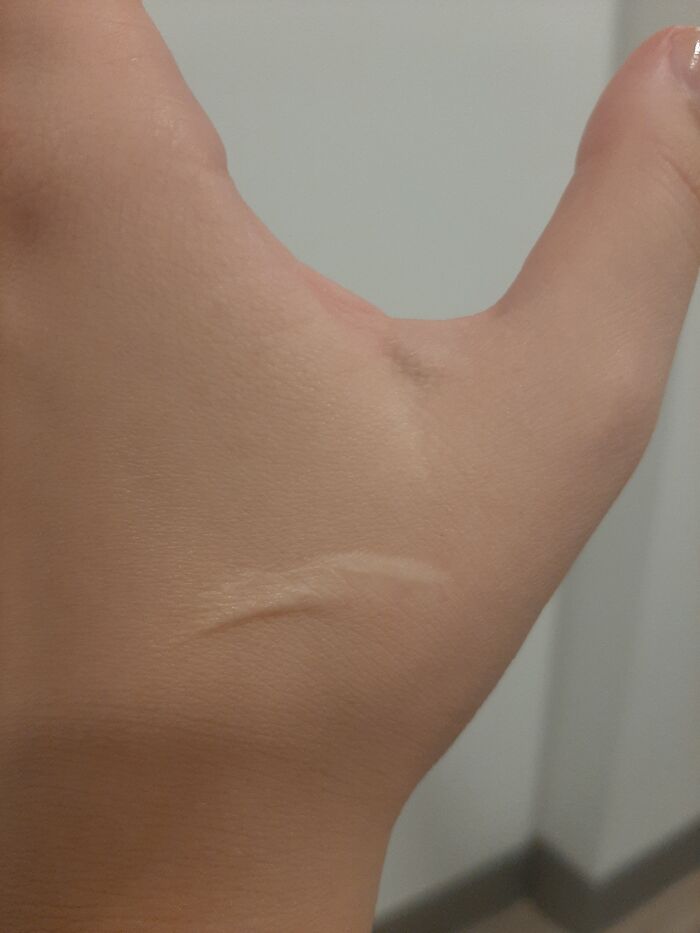 Carrot Chaos! I Peeled A Carrot By Slicing The Damn Vegetable Towards Me Instead Of Away