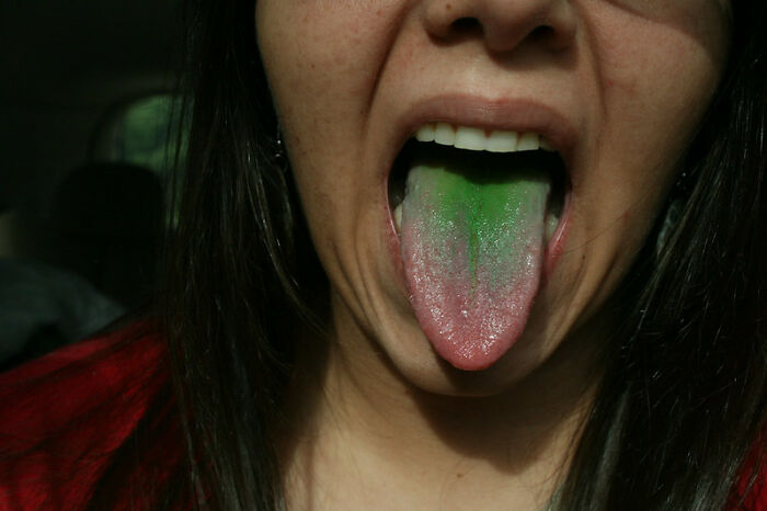 40 Bizarre, Uplifting, Or Straight Up Chucklesome, Yet Unlikely Personal Stories As Shared Online That Are Very Much True