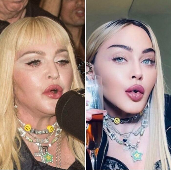 Side-by-side photos showing contrast between real and edited Instagram reality with exaggerated facial features.