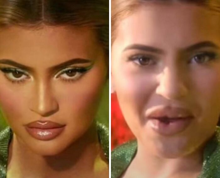 An Example Of How Fillers Look Online vs. Real Life