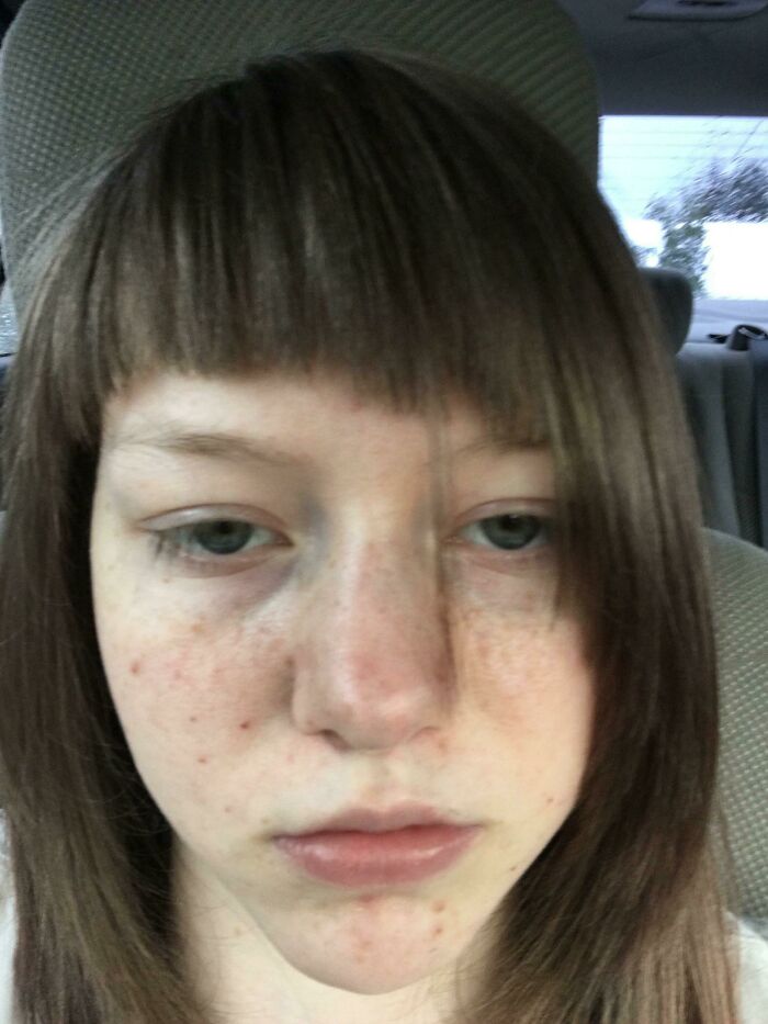 Young person with a short, uneven haircut sitting in a car, exemplifying a bad haircut idea.