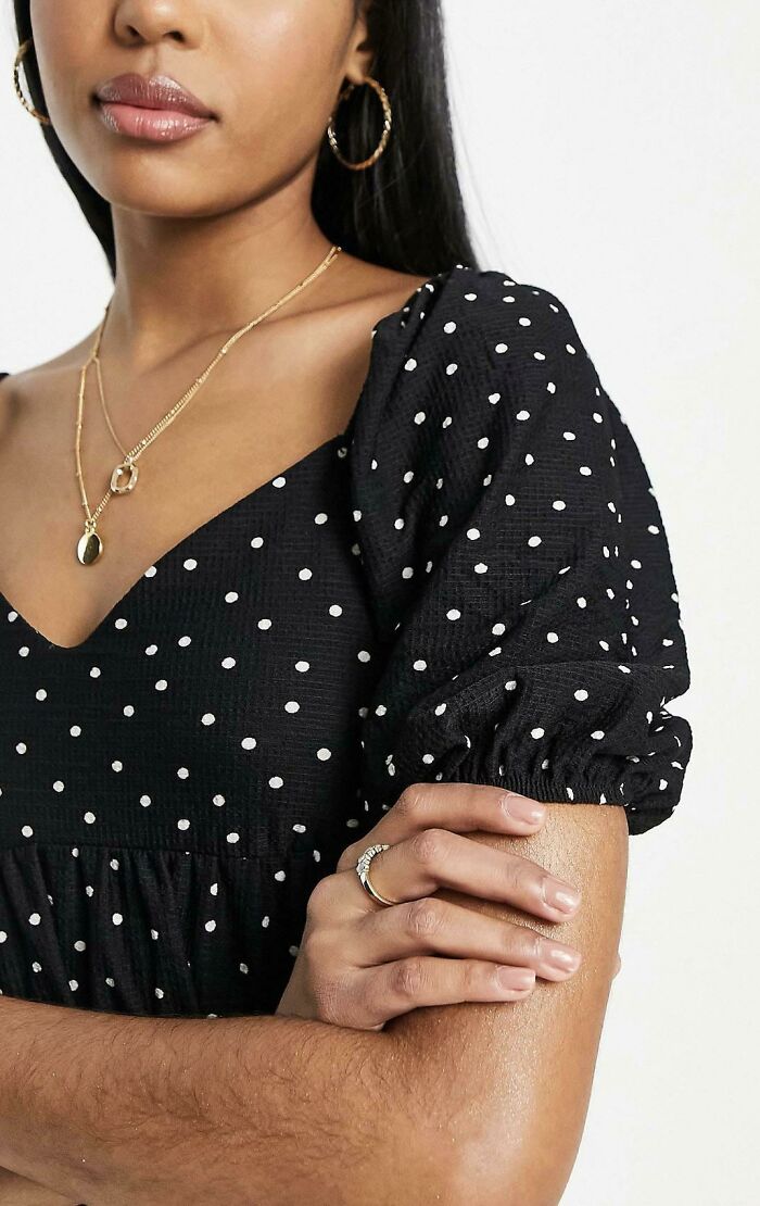 ¡La existencia del vello en los brazos!