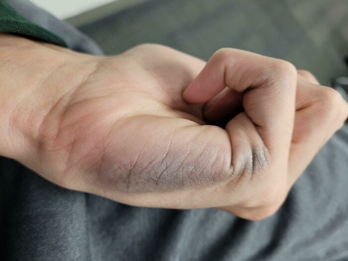 This Happens To Everyone, I Write A Lot. Problems Of Writing Left-Handed