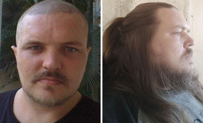 From Bald After My 2nd Battle With Cancer To Now During My 3rd Battle With Cancer ( 5 Years Growth )