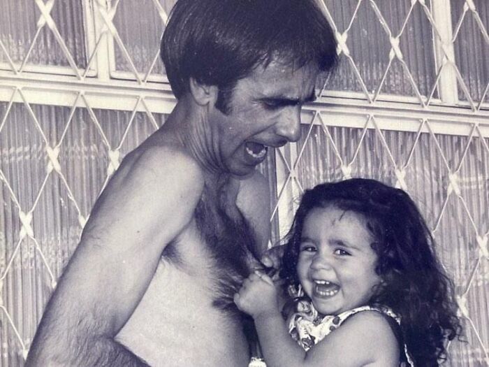 Los efectos secundarios de la paternidad pueden incluir pérdida de pelo atípica