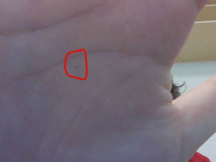 Accidentally Stabbed Myself With A Pencil In 5th Grade