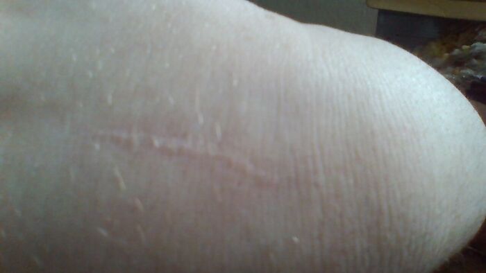 My Sister Gave Me This After Using A Crayon! Back Of My Hand. Not Super Visible, But It's There