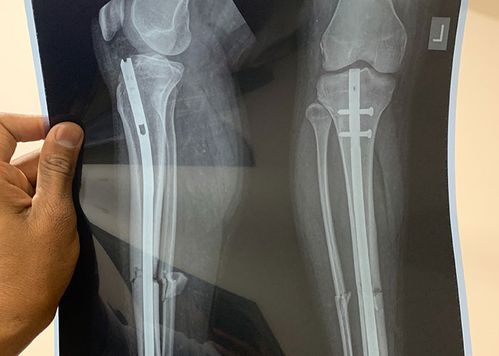 20 Momentos descabellados vividos por médicos cuando los pacientes olvidaron mencionar algo importante