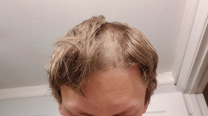 After Fixing My Hair Trimmer, I Forgot To Put The Depth Thing On