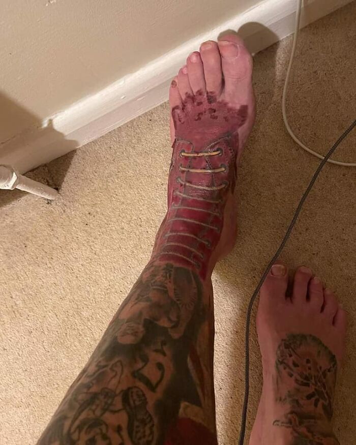 Dr Martens In Process Lol. Why!?! Looks Like His Skin Was Peeled Off His Foot