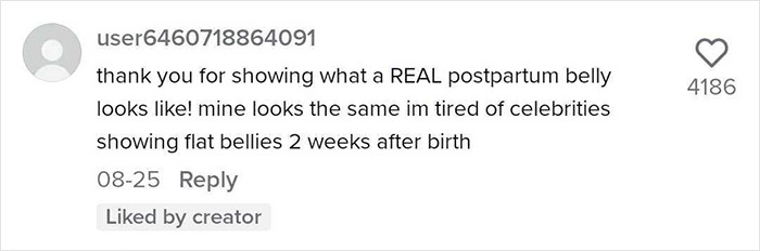 TikTok Mom Exposes Her Postpartum Journey To Combat Unrealistic Depictions Of Post-Pregnancy Bodies