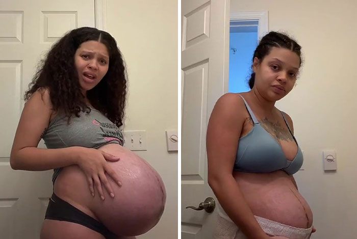 TikTok Mom Exposes Her Postpartum Journey To Combat Unrealistic Depictions Of Post-Pregnancy Bodies