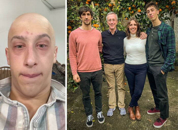 Yo sufriendo de cáncer durante la primavera vs. Yo feliz y saludable pasando la Navidad con mi hermosa familia