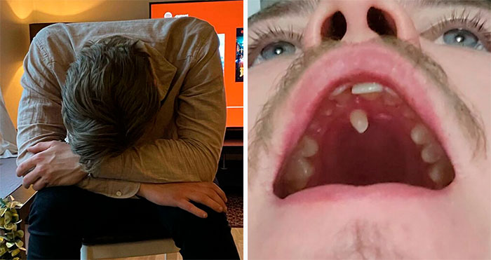 50 Photos Of Unique People That Show That Genetics Is Hard To Predict (New Pics)