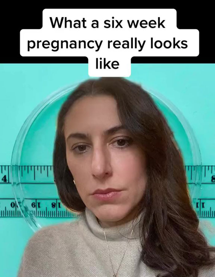 Some Anti-Abortion Folks Were Not Ready To See That A Pregnancy At 6 Weeks Doesn’t Have A Growing Embryo And Is Only Bodily Tissue Some Anti-Abortion Folks Were Not Ready To See That A Pregnancy At 6 Weeks Doesn’t Have A Growing Embryo And Is Only Bodily Tissue