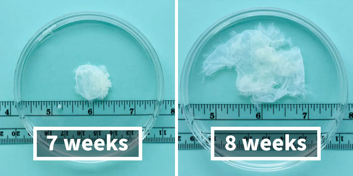 Some Anti-Abortion Folks Were Not Ready To See That A Pregnancy At 6 Weeks Doesn’t Have A Growing Embryo And Is Only Bodily Tissue Some Anti-Abortion Folks Were Not Ready To See That A Pregnancy At 6 Weeks Doesn’t Have A Growing Embryo And Is Only Bodily Tissue