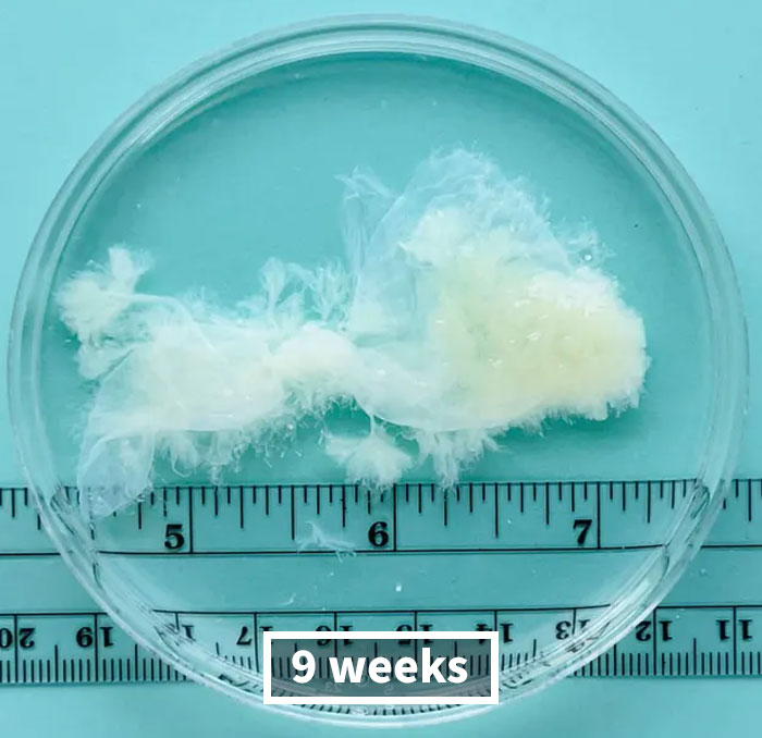 Some Anti-Abortion Folks Were Not Ready To See That A Pregnancy At 6 Weeks Doesn’t Have A Growing Embryo And Is Only Bodily Tissue Some Anti-Abortion Folks Were Not Ready To See That A Pregnancy At 6 Weeks Doesn’t Have A Growing Embryo And Is Only Bodily Tissue