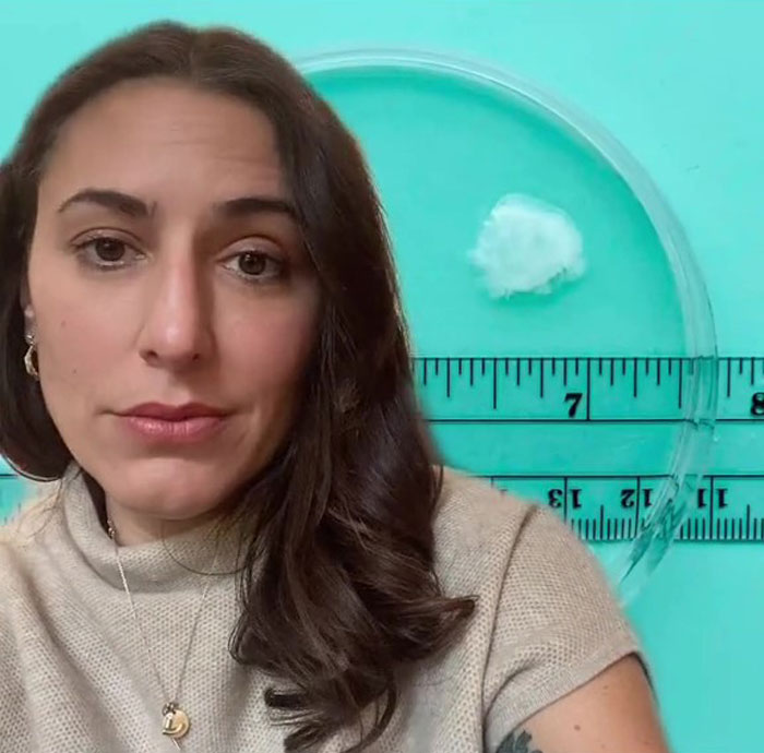 Some Anti-Abortion Folks Were Not Ready To See That A Pregnancy At 6 Weeks Doesn’t Have A Growing Embryo And Is Only Bodily Tissue Some Anti-Abortion Folks Were Not Ready To See That A Pregnancy At 6 Weeks Doesn’t Have A Growing Embryo And Is Only Bodily Tissue