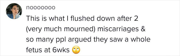 Some Anti-Abortion Folks Were Not Ready To See That A Pregnancy At 6 Weeks Doesn’t Have A Growing Embryo And Is Only Bodily Tissue Some Anti-Abortion Folks Were Not Ready To See That A Pregnancy At 6 Weeks Doesn’t Have A Growing Embryo And Is Only Bodily Tissue