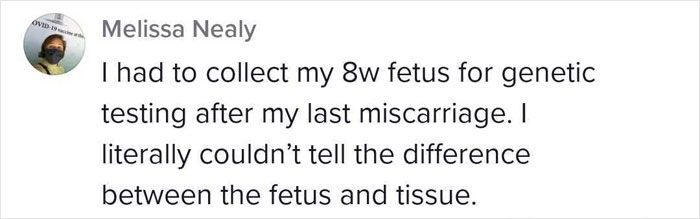 Some Anti-Abortion Folks Were Not Ready To See That A Pregnancy At 6 Weeks Doesn’t Have A Growing Embryo And Is Only Bodily Tissue Some Anti-Abortion Folks Were Not Ready To See That A Pregnancy At 6 Weeks Doesn’t Have A Growing Embryo And Is Only Bodily Tissue