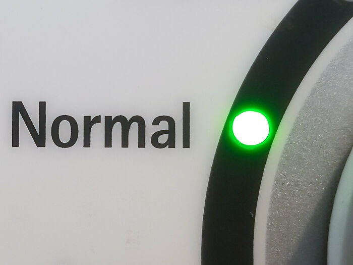 20 Personas que pensaban que algo era normal y al final descubrieron que no lo era