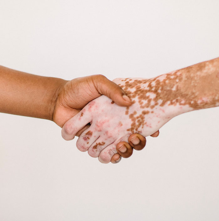 The Paradox Of Tolerance