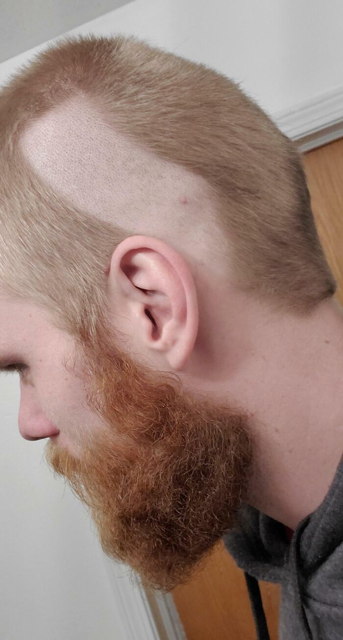 Intenté ahorrar dinero haciendo que mi compañera de piso me cortara el pelo. Se olvidó de que había quitado el protector