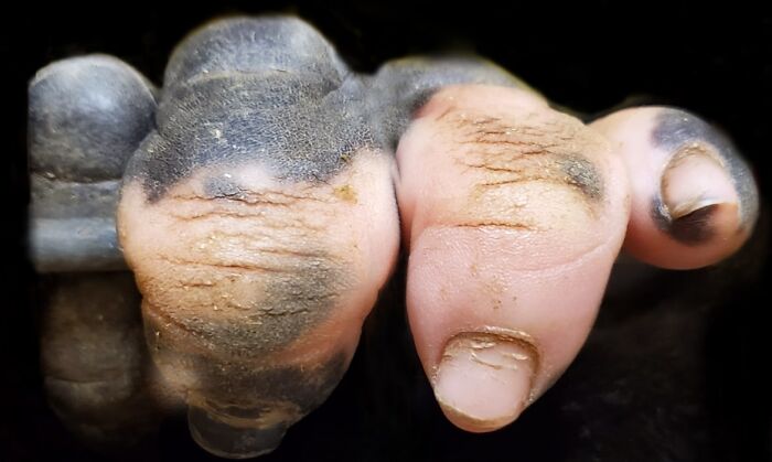 The Fingers Of A Gorilla With Vitiligo