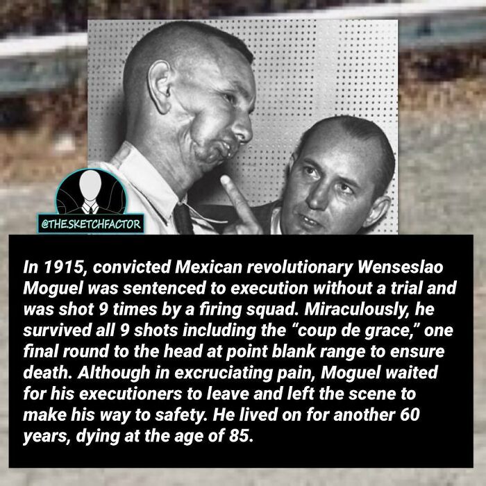 Black and white photo of a man with facial wounds and another man pointing, illustrating disturbing and morbid facts.
