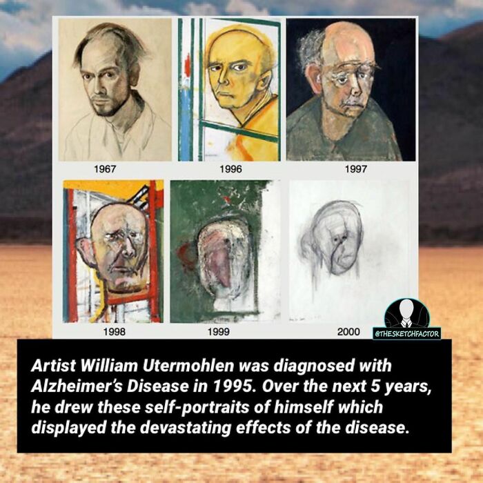 Series of deteriorating self-portraits by artist William Utermohlen showing the morbid effects of Alzheimer's disease.