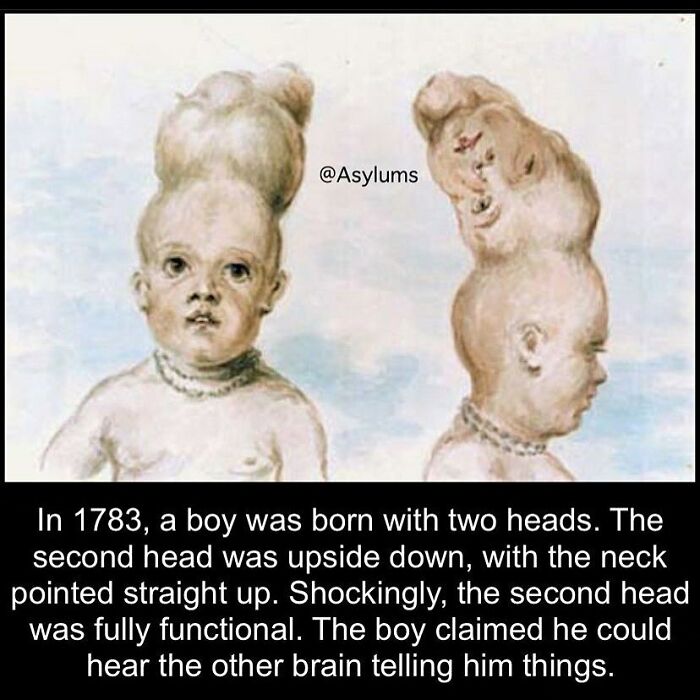 Illustration of a boy with two heads, one upside down, depicting a creepy fact from random creepy facts and pictures.