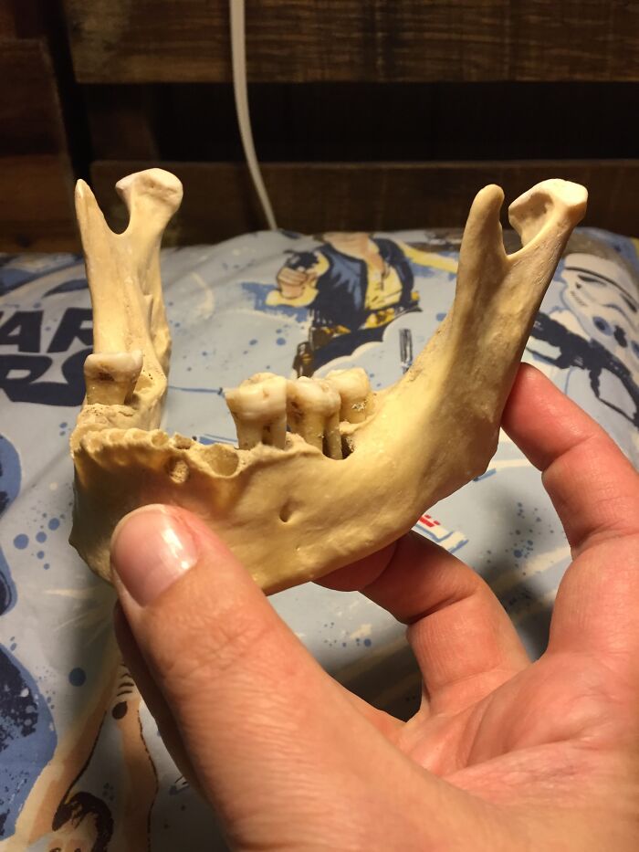 A Human Mandible